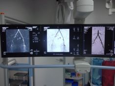  Monitory diagnostyczne umieszczone nad stoem radiologicznym